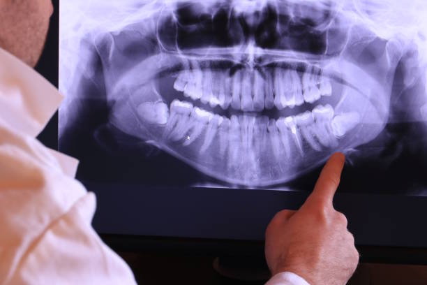 Best Emergency Gum Treatment in Canton, GA
